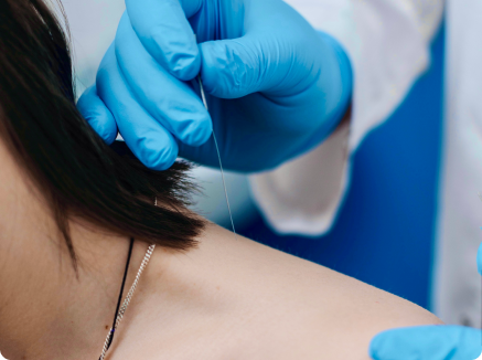 «DRY NEEDLE» метод сухой иглы