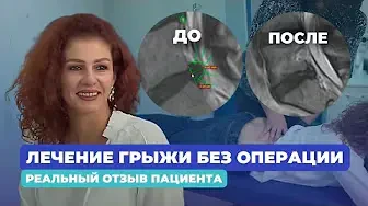Грыжа в спине вылечена БЕЗ ОПЕРАЦИИ! Реальный отзыв пациента